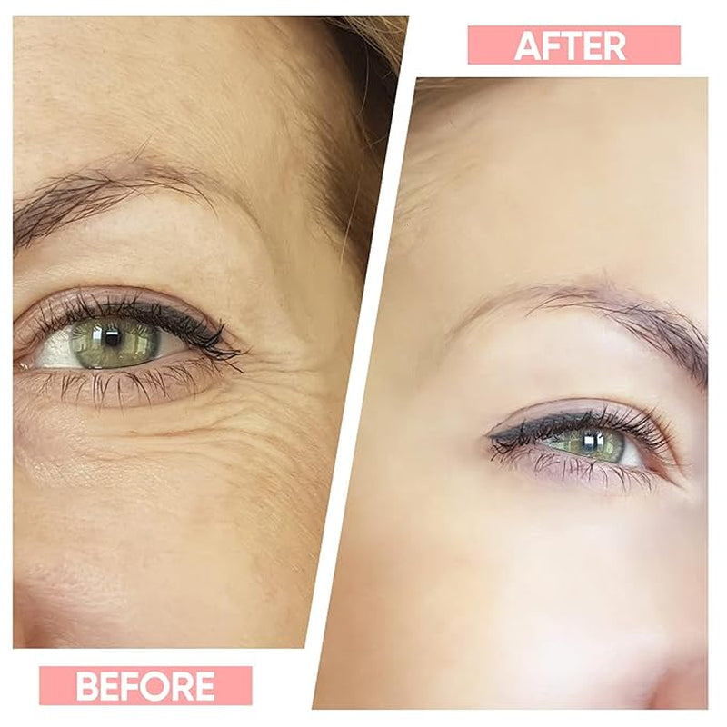 Professional Facial Massager for Skin Care | Double Chin Reduction | 7 Color Modes | Face Sculpting Device | Thermal, Vibration, Microcurrent Technology | USPS/UPS Tracking (US Shipping Only)